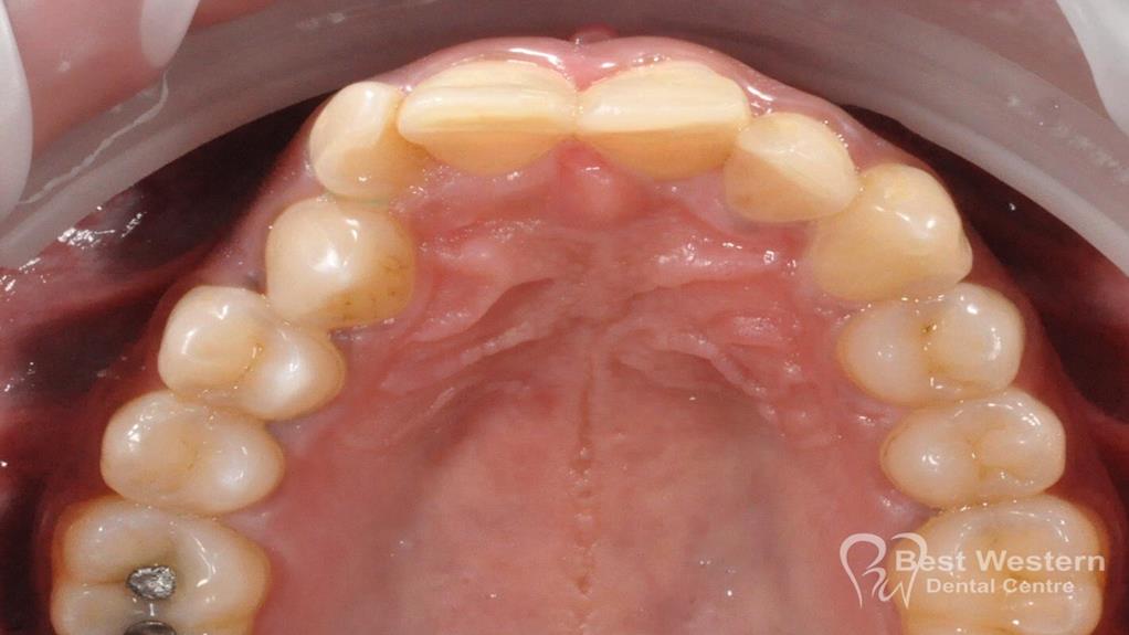 Before-Ortho - 24